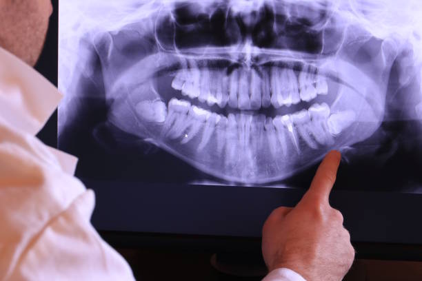 Best 24-Hour Emergency Dentist in Swannanoa, NC